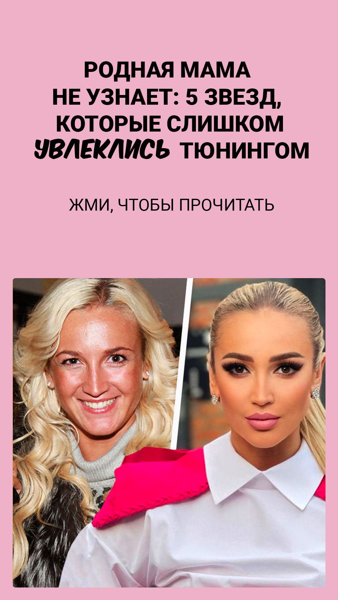 Родная мама не узнает: 5 звезд, которые слишком увлеклись тюнингом